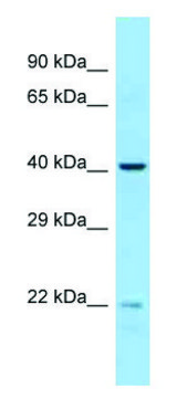 Anti-EME2 antibody produced in rabbit