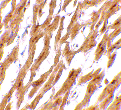 Anti-ASAH1 antibody produced in rabbit