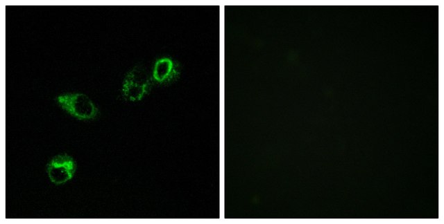 Anti-CCRL1 antibody produced in rabbit
