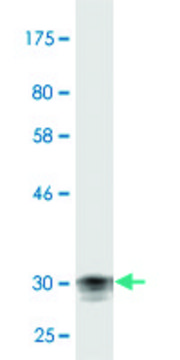 Monoclonal Anti-CDSN antibody produced in