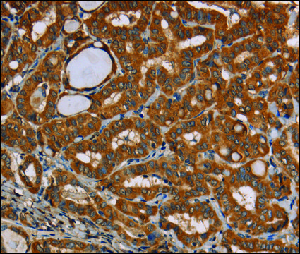 Anti-CENPU antibody produced in rabbit