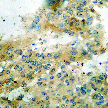 Anti-phospho-GATA1 (pSer³¹?) antibody produced in