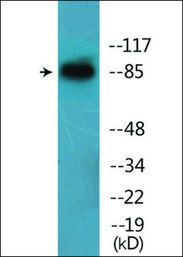 Anti-phospho-Catenin-? (pTyr???) antibody produced in