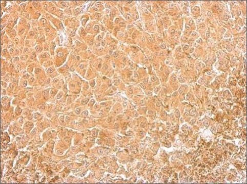 Monoclonal Anti-Cofilin 1 antibody produced