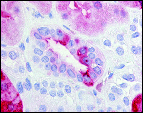 Anti-PTGER2 (AB3) antibody produced in