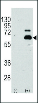 ANTI-S6K (RPS6KB1) (S404) antibody produced