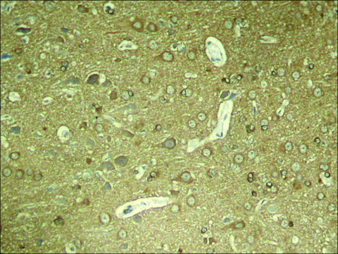 Anti-phospho-MAPT (pSer???) antibody produced in