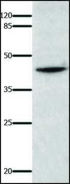 Anti-IL18BP antibody produced in rabbit