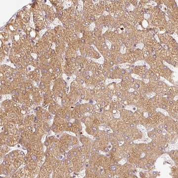 Anti-SERPING1 antibody produced in rabbit