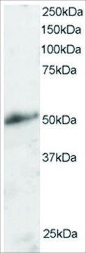 Anti-KLF8/BKLF3 antibody produced in goat