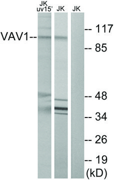 Anti-VAV1 antibody produced in rabbit