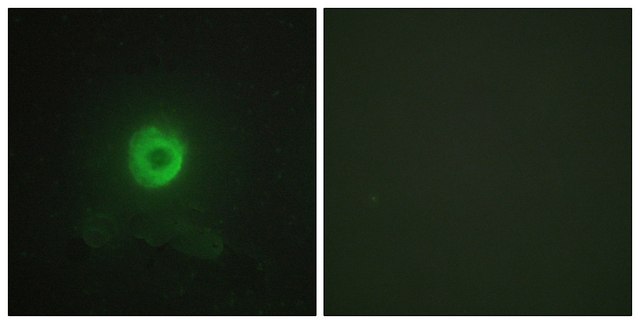 Anti-TNF Receptor II, antibody produced