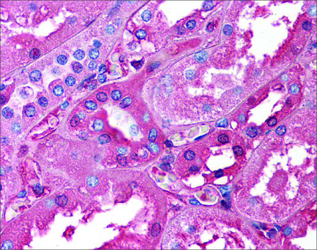 Anti-ALB (ab2) antibody produced in