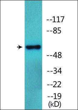 Anti-phospho-LCK (pSer??) antibody produced in