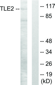 Anti-TLE2 antibody produced in rabbit