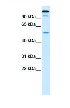 Anti-UHRF2 antibody produced in rabbit