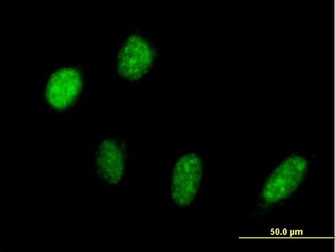 Anti-PRPF18 antibody produced in mouse