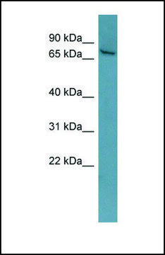 Anti-ESR1, (N-terminal) antibody produced in