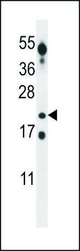 ANTI-CT45A (CENTER) antibody produced in