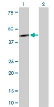 Anti-IL12RB1 antibody produced in rabbit