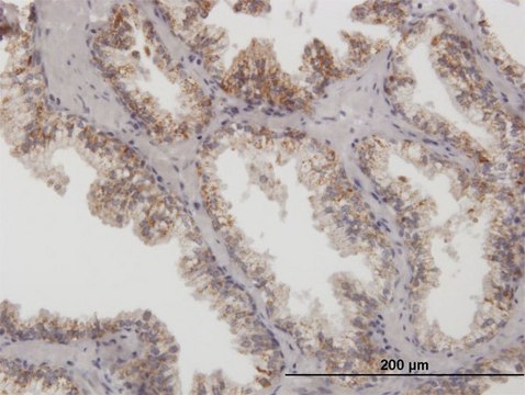 Anti-ARG2 antibody produced in mouse