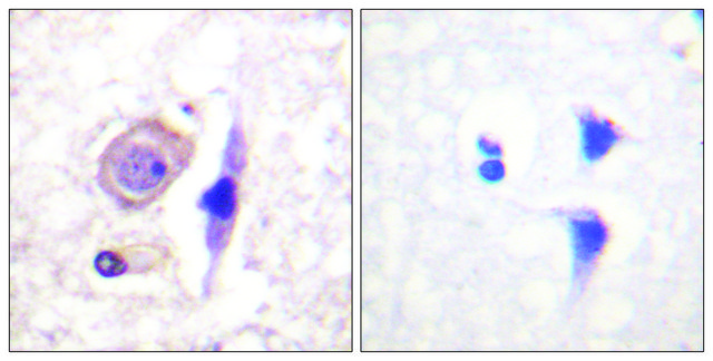 Anti-Interferon-? Receptor ? chain antibody