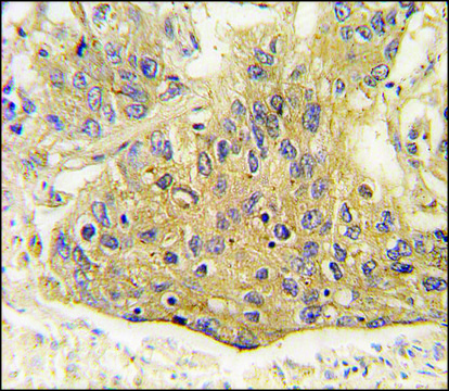 Anti-AARS2 (center) antibody produced in