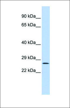 Anti-GATAD1 antibody produced in rabbit