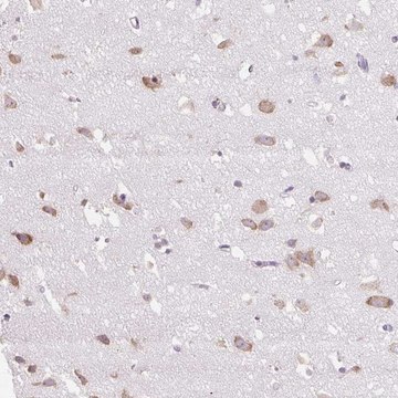 Anti-GPR45 antibody produced in rabbit