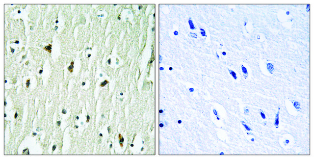 Anti-CSK antibody produced in rabbit