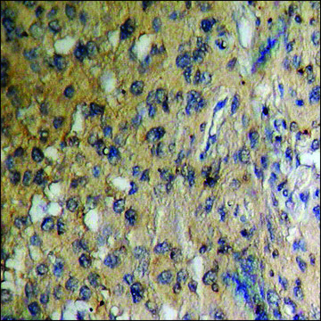 Anti-phospho-Caspase 6 (pSer²??) antibody produced