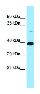 Anti-IST1 (N-terminal) antibody produced in