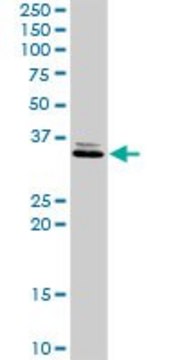 Anti-RDHE2 antibody produced in rabbit