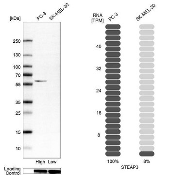 Anti-STEAP3 antibody produced in rabbit
