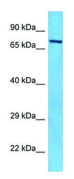 Anti-PAK6 (C-terminal) antibody produced in