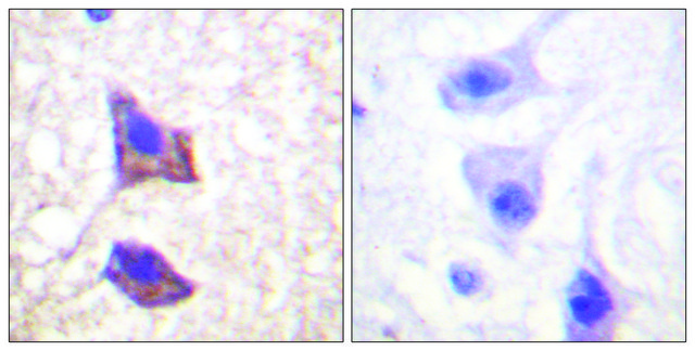 Anti-CD130 antibody produced in rabbit