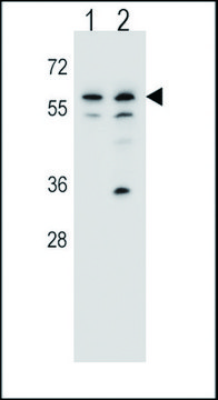 ANTI-MOUSE PINK (CENTER) antibody produced