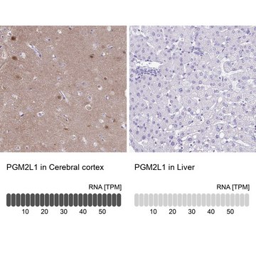 Anti-PGM2L1 antibody produced in rabbit