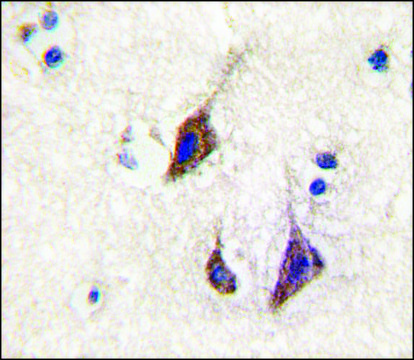 Anti-CDK5R2(p39) (N-term) antibody produced in