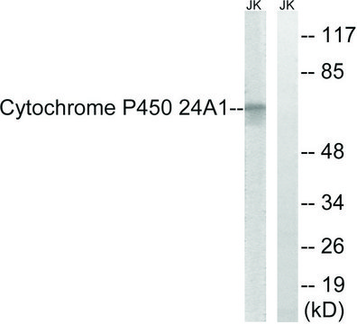 Anti-Cytochrome P450 24A1 antibody produced