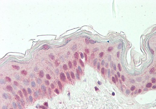 Anti-RARG antibody produced in rabbit