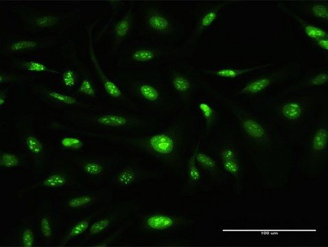 Anti-ATOH7 antibody produced in rabbit