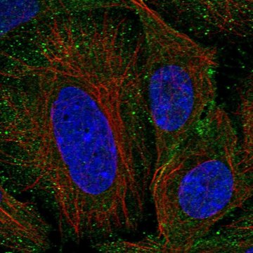 Anti-SEM1 antibody produced in rabbit