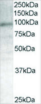 Anti-Androgen Receptor antibody produced in