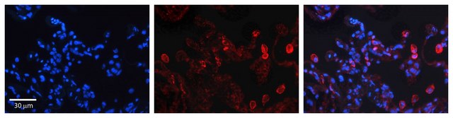 Anti-DEGS1 antibody produced in rabbit