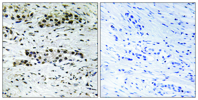 Anti-phospho-Estrogen Receptor-? (pSer¹?²) antibody produced