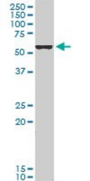 ANTI-FOXC2 antibody produced in mouse
