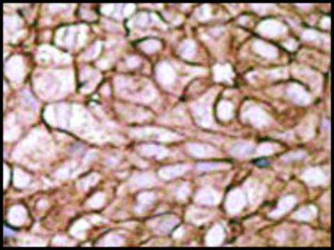Anti-PDX1 (N-term) antibody produced in