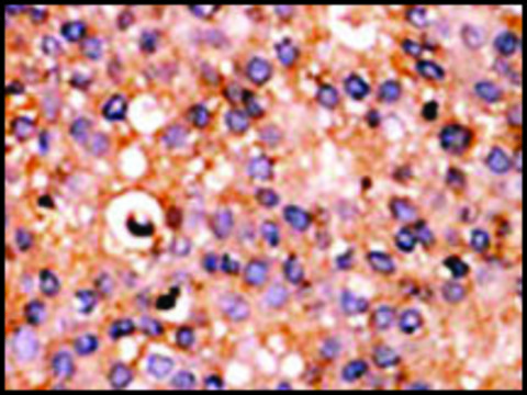 Anti-PSKH1 (N-term L9) antibody produced