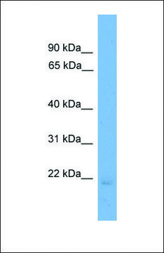 Anti-EDN2, (N-terminal) antibody produced in